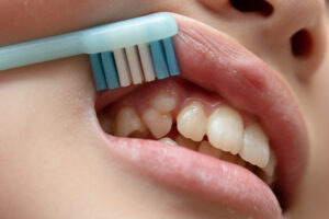 歯ブラシで唇をめくって八重歯を見せる人