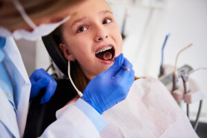歯科院で治療を受ける女の子