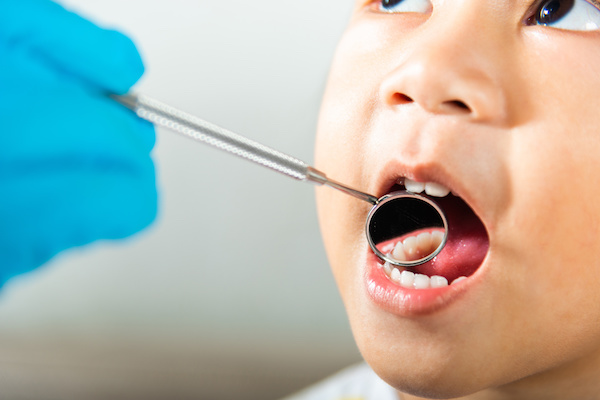歯の治療を受ける子供